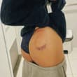 Slapped too hard or the bitter harvest of the road accident? ...Anyways looks j…
