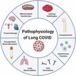 A Review in Communications Medicine explores Long COVID — which affects more th…