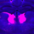 MIT neuroscientists have identified a brain circuit involved in processing new…