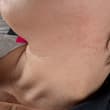 早上起來脖子就過敏還是啥的，癢
