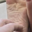 The exposed bare sole will reflexively recoil when overstimulated.