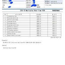 클린자지