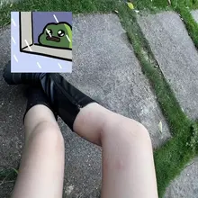 战损版