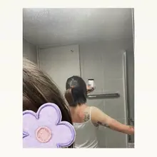 ㅎ .. 날 흐리다구 우습게 본 내잘못; 약 발라 줄사람 ㅠㅡㅠ ?