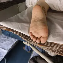 投稿 臥鋪肉腳