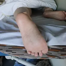 投稿 臥鋪肉腳