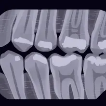 Japan is testing an experimental drug that could help people grow new teeth by…
