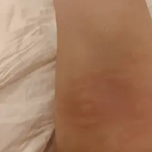 铁砂掌✋️