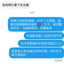 想看阴道瓣形态一定要拍特写，手扒开阴唇