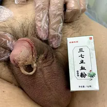 穿完环要包扎？ 答:需要碘伏喷雾消毒后，撒上止血粉，在用纱布包扎好。每天需要更换。更换7天结束。 #大学生 #西安线下 #029西安 #专业穿孔 #深pa #…