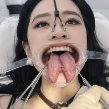最近是真的忙，这阵子忙过了抽空做点精品内容出来，附一张亦菲分舌手术图