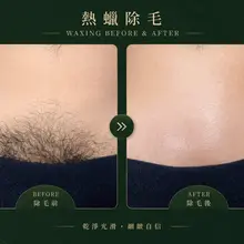 正規熱蠟除毛 IG 99chu.chu 歡迎有除毛需求私訊我～ 性需求別找我🫶🏻
