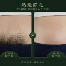 正規熱蠟除毛 IG 99chu.chu 歡迎有除毛需求私訊我～ 性需求別找我🫶🏻