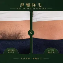 正規熱蠟除毛 IG 99chu.chu 歡迎有除毛需求私訊我～ 性需求別找我🫶🏻